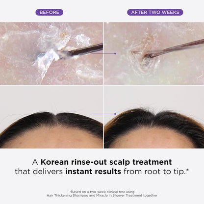 Dr. Groot Thickening Shampoo & Scalp Treatment Set for Hair Loss – Clinical Results with Biotin and Rosemary for Hair Thinning, Shedding, Scalp Repair and Treatment